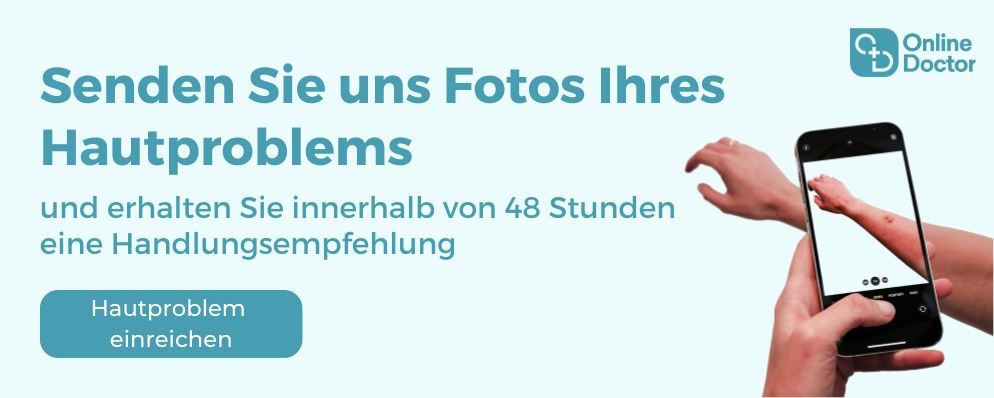 Banner «Senden Sie uns Fotos Ihres Hautproblems, und erhalten Sie innerhalb von 48 Stunden eine Handlungsempfehlung» Link: https://www.onlinedoctor.ch/de/doctors/d/dr-med-monika-donath